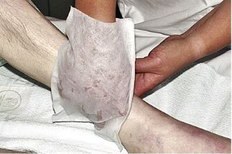 WASCHHANDSCHUHE – Bild 3